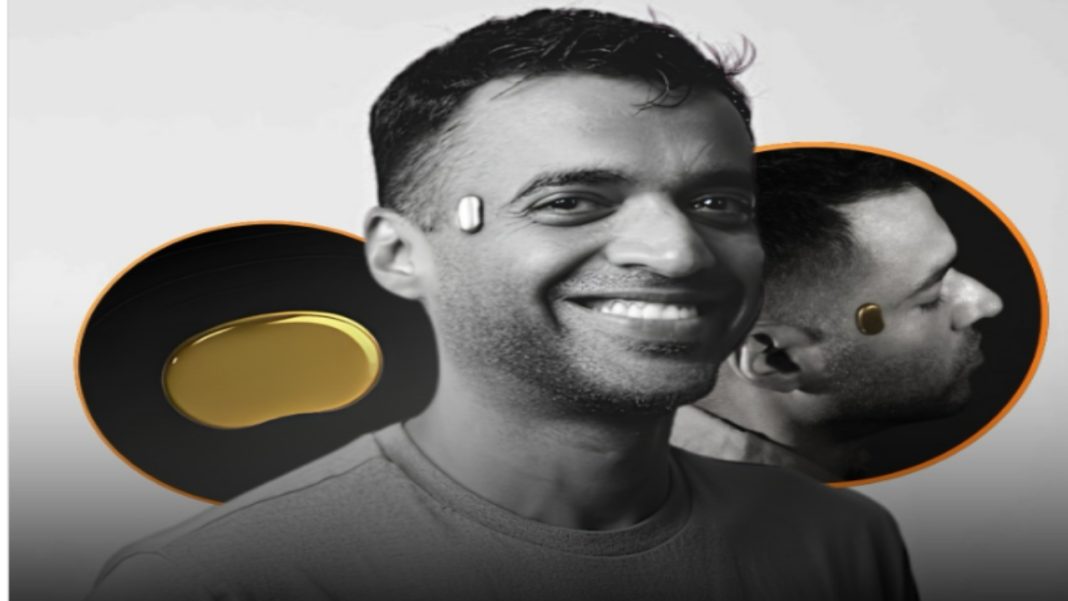 Deepinder Goyal’s ‘Temple’ Wearable Moves Closer To India Launch: Can A Tiny Device On Your Head Track Brain Blood Flow, Stress And Recovery? Deepinder Goyal Temple wearable head-mounted brain tracking device