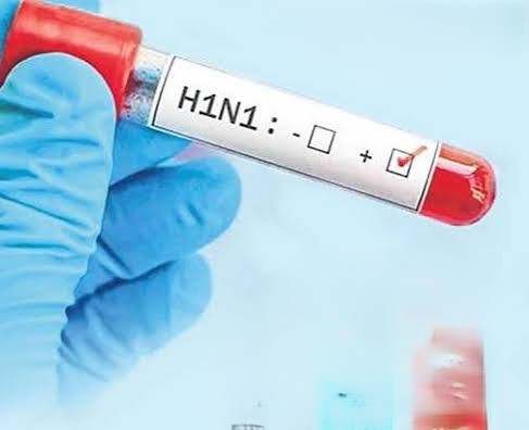 H1N1 Cases Rise Across Delhi-NCR: Which Symptoms Should Families Not Ignore This Monsoon? Delhi-NCR H1N1 and seasonal flu cases during monsoon